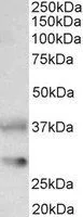 WB analysis of rat brain lysate using GTX88520 Clusterin antibody, C-term. Dilution : 0.1microg/ml Loading : 35microg protein in RIPA buffer WB analysis of rat brain lysate using GTX88520 Clusterin antibody, C-term. Dilution : 0.1microg/ml Loading : 35microg protein in RIPA buffer