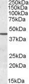 WB analysis of human testis lysate using GTX88523 Septin 2 antibody, N-term. Dilution : 0.05microg/ml Loading : 35microg protein in RIPA buffer WB analysis of human testis lysate using GTX88523 Septin 2 antibody, N-term. Dilution : 0.05microg/ml Loading : 35microg protein in RIPA buffer