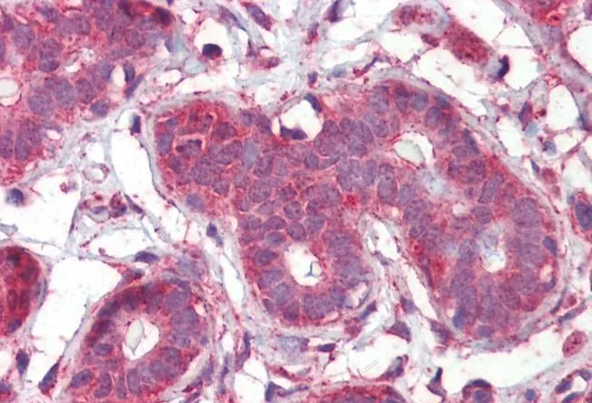 IHC-P analysis of human breast using GTX88523 Septin 2 antibody, N-term. Antigen retrieval : citrate buffer pH 6 Dilution : 2.5microg/ml