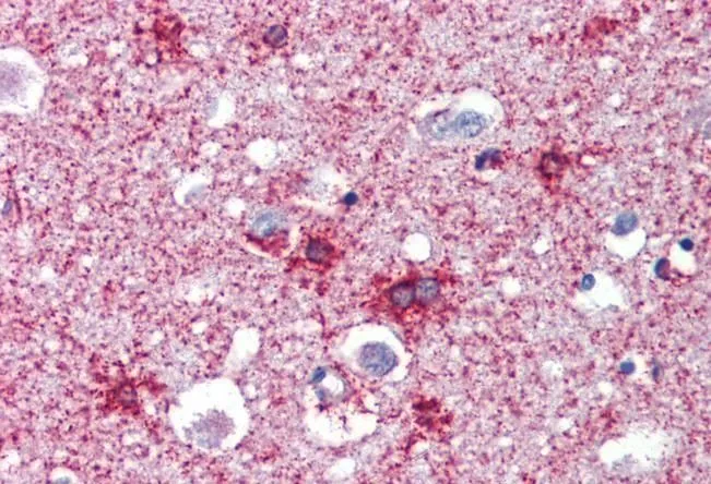 IHC-P analysis of human cortex using GTX88523 Septin 2 antibody, N-term. Antigen retrieval : citrate buffer pH 6 Dilution : 2.5microg/ml