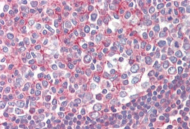 IHC-P analysis of human tonsil using GTX88523 Septin 2 antibody, N-term. Antigen retrieval : citrate buffer pH 6 Dilution : 2.5microg/ml