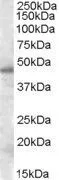 WB analysis of HeLa nuclear lysate using GTX88524 SEPT7 antibody,Internal. Dilution : 0.5ug/ml Loading : 35ug protein in RIPA buffer
