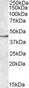 WB analysis of Molt-4 cell lysate using GTX88527 SIGLEC8 antibody,Internal. Dilution : 0.3ug/ml Loading : 35ug protein in RIPA buffer
