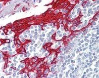 IHC-P analysis of human tonsil using GTX88529 Cytokeratin 13 antibody, C-term. Antigen retrieval : citrate buffer pH 6 Dilution : 2.5microg/ml