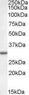 WB analysis of rat liver lysate using GTX88561 Dpm1 antibody, N-term. Dilution : 0.05microg/ml Loading : 35microg protein in RIPA buffer