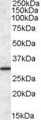 WB analysis of human liver lysate using GTX88567 ERP29 antibody, C-term. Dilution : 0.1microg/ml Loading : 35microg protein in RIPA buffer WB analysis of human liver lysate using GTX88567 ERP29 antibody, C-term. Dilution : 0.1microg/ml Loading : 35microg protein in RIPA buffer