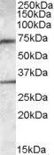 WB analysis of human liver lysate using GTX88568 Endothelial Lipase / LIPG antibody, Internal. Dilution : 0.3microg/ml Loading : 35microg protein in RIPA buffer WB analysis of human liver lysate using GTX88568 Endothelial Lipase / LIPG antibody, Internal. Dilution : 0.3microg/ml Loading : 35microg protein in RIPA buffer