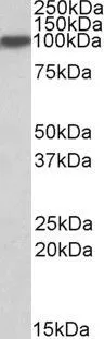 WB analysis of human liver lysate using GTX88570 Aconitase 1 antibody, Internal. Dilution : 0.1microg/ml Loading : 35microg protein in RIPA buffer WB analysis of human liver lysate using GTX88570 Aconitase 1 antibody, Internal. Dilution : 0.1microg/ml Loading : 35microg protein in RIPA buffer