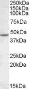 WB analysis of human cerebellum lysate using GTX88583 AChR beta 2 antibody, Internal. Dilution : 1microg/ml Loading : 35microg protein in RIPA buffer WB analysis of human cerebellum lysate using GTX88583 AChR beta 2 antibody, Internal. Dilution : 1microg/ml Loading : 35microg protein in RIPA buffer
