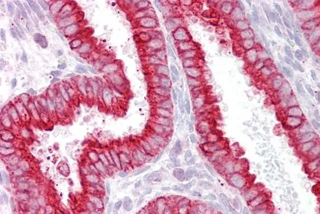 IHC-P analysis of human uterus using GTX88583 AChR beta 2 antibody, Internal. Antigen retrieval : citrate buffer pH 6 Dilution : 2.5microg/ml