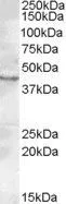 WB analysis of rat testis lysate using GTX88586 LASS3 antibody, C-term. Dilution : 0.2microg/ml Loading : 35microg protein in RIPA buffer WB analysis of rat testis lysate using GTX88586 LASS3 antibody, C-term. Dilution : 0.2microg/ml Loading : 35microg protein in RIPA buffer