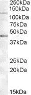 WB analysis of Jurkat lysate using GTX88590 Tankyrase 2 antibody, Internal. Dilution : 0.5microg/ml Loading : 35microg protein in RIPA buffer WB analysis of Jurkat lysate using GTX88590 Tankyrase 2 antibody, Internal. Dilution : 0.5microg/ml Loading : 35microg protein in RIPA buffer
