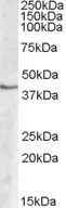 WB analysis of human peripheral blood mononucleocyte lysate using GTX88593 SPHK1 antibody, Internal. Dilution : 2microg/ml Loading : 35microg protein in RIPA buffer WB analysis of human peripheral blood mononucleocyte lysate using GTX88593 SPHK1 antibody, Internal. Dilution : 2microg/ml Loading : 35microg protein in RIPA buffer