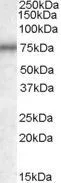 WB analysis of K562 lysate using GTX88595 Bin3 antibody, Internal. Dilution : 0.3microg/ml Loading : 35microg protein in RIPA buffer WB analysis of K562 lysate using GTX88595 Bin3 antibody, Internal. Dilution : 0.3microg/ml Loading : 35microg protein in RIPA buffer