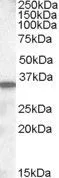 WB analysis of mouse small intestine lysate using GTX88608 ASBT antibody, C-term. Dilution : 0.5microg/ml Loading : 35microg protein in RIPA buffer WB analysis of mouse small intestine lysate using GTX88608 ASBT antibody, C-term. Dilution : 0.5microg/ml Loading : 35microg protein in RIPA buffer
