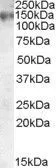 WB analysis of A549 lysate using GTX88617 MRP1 antibody, Internal. Dilution : 0.05microg/ml Loading : 35microg protein in RIPA buffer WB analysis of A549 lysate using GTX88617 MRP1 antibody, Internal. Dilution : 0.05microg/ml Loading : 35microg protein in RIPA buffer