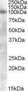 WB analysis of A549 lysate using GTX88618 FGFR2 antibody, Internal. Dilution : 0.3microg/ml Loading : 35microg protein in RIPA buffer WB analysis of A549 lysate using GTX88618 FGFR2 antibody, Internal. Dilution : 0.3microg/ml Loading : 35microg protein in RIPA buffer