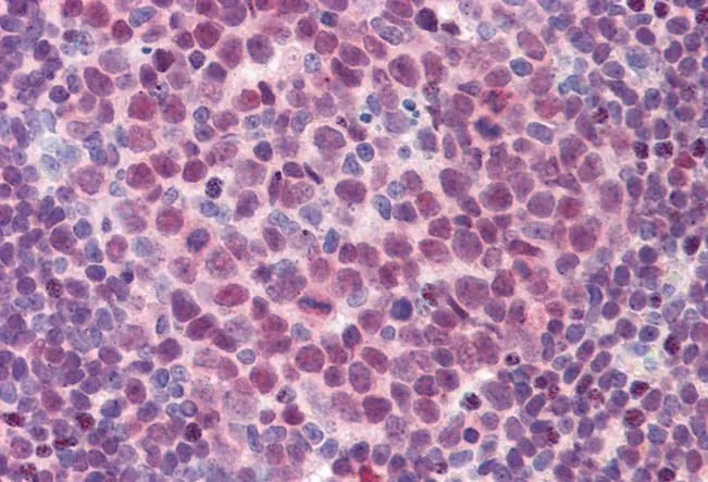 IHC-P analysis of human colon using GTX88620 PU.1 antibody, Internal. Antigen retrieval : citrate buffer pH 6 Dilution : 3.75microg/ml