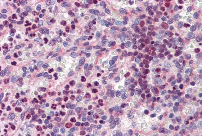 IHC-P analysis of human spleen using GTX88620 PU.1 antibody, Internal. Antigen retrieval : citrate buffer pH 6 Dilution : 3.75microg/ml