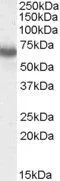 WB analysis of Molt-4 cell lysate using GTX88621 Ikaros antibody, Internal. Dilution : 0.03microg/ml Loading : 35microg protein in RIPA buffer WB analysis of Molt-4 cell lysate using GTX88621 Ikaros antibody, Internal. Dilution : 0.03microg/ml Loading : 35microg protein in RIPA buffer