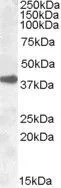 WB analysis of A431 lysate using GTX88627 ERCC1 antibody, N-term. Dilution : 0.3microg/ml Loading : 35microg protein in RIPA buffer