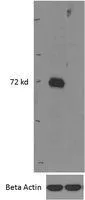 WB analysis of mouse bone marrow (wildtype first lane, KO second lane) lysates using GTX88632 IRAK3 antibody, Internal. Dilution : 0.5microg/ml Loading : 35microg protein in RIPA buffer
