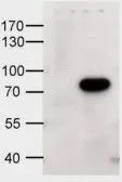 WB analysis of HEK293 overexpressing human ABCD1 (mock transfection in first lane) using GTX88645 ABCD1 antibody, Internal. Dilution : 1microg/ml WB analysis of HEK293 overexpressing human ABCD1 (mock transfection in first lane) using GTX88645 ABCD1 antibody, Internal. Dilution : 1microg/ml