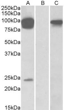WB analysis of HEK293 overexpressing human TRPV3 with DYKDDDDK tag using GTX88648 TRPV3 antibody, Internal. Lane A : primary antibody Lane B : Mock-transfected HEK293 probed with primary antibody Lane C : Tag antibody Dilution : 0.5microg/ml Loading : 10microg protein in RIPA buffer WB analysis of HEK293 overexpressing human TRPV3 with DYKDDDDK tag using GTX88648 TRPV3 antibody, Internal. Lane A : primary antibody Lane B : Mock-transfected HEK293 probed with primary antibody Lane C : Tag antibody Dilution : 0.5microg/ml Loading : 10microg protein in RIPA buffer