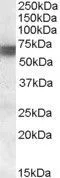 WB analysis of human skeletal muscle lysate using GTX88650 BIN1 antibody, Internal. Dilution : 0.1microg/ml Loading : 35microg protein in RIPA buffer WB analysis of human skeletal muscle lysate using GTX88650 BIN1 antibody, Internal. Dilution : 0.1microg/ml Loading : 35microg protein in RIPA buffer