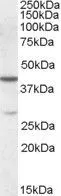 WB analysis of K562 lysate using GTX88655 CBX8 antibody, Internal. Dilution : 0.1microg/ml Loading : 35microg protein in RIPA buffer WB analysis of K562 lysate using GTX88655 CBX8 antibody, Internal. Dilution : 0.1microg/ml Loading : 35microg protein in RIPA buffer
