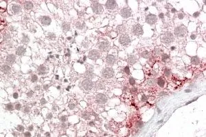 IHC-P analysis of human testis using GTX88667 PMP70 antibody, Internal. Antigen retrieval : citrate buffer pH 6 Dilution : 3.8microg/ml