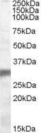 WB analysis of human muscle lysate using GTX88678 PHD3 antibody, Internal. Dilution : 0.1microg/ml Loading : 35microg protein in RIPA buffer WB analysis of human muscle lysate using GTX88678 PHD3 antibody, Internal. Dilution : 0.1microg/ml Loading : 35microg protein in RIPA buffer