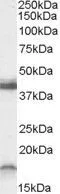 WB analysis of rat brain lysate using GTX88679 Ramp1 (C-Term., mouse) antibody, C-term. Dilution : 0.3microg/ml Loading : 35microg protein in RIPA buffer WB analysis of rat brain lysate using GTX88679 Ramp1 (C-Term., mouse) antibody, C-term. Dilution : 0.3microg/ml Loading : 35microg protein in RIPA buffer