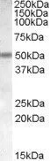 WB analysis of human cerebellum lysate using GTX88687 AChR beta 3 antibody, Internal. Dilution : 1microg/ml Loading : 35microg protein in RIPA buffer WB analysis of human cerebellum lysate using GTX88687 AChR beta 3 antibody, Internal. Dilution : 1microg/ml Loading : 35microg protein in RIPA buffer