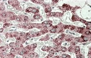 IHC-P analysis of human liver- using GTX88705 SCP2 antibody, Internal. Antigen retrieval : citrate buffer pH 6 Dilution : 3.8microg/ml IHC-P analysis of human liver- using GTX88705 SCP2 antibody, Internal. Antigen retrieval : citrate buffer pH 6 Dilution : 3.8microg/ml