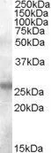 WB analysis of human tonsil lysate using GTX88708 AICDA antibody, N-term. Dilution : 0.1microg/ml Loading : 35microg protein in RIPA buffer WB analysis of human tonsil lysate using GTX88708 AICDA antibody, N-term. Dilution : 0.1microg/ml Loading : 35microg protein in RIPA buffer