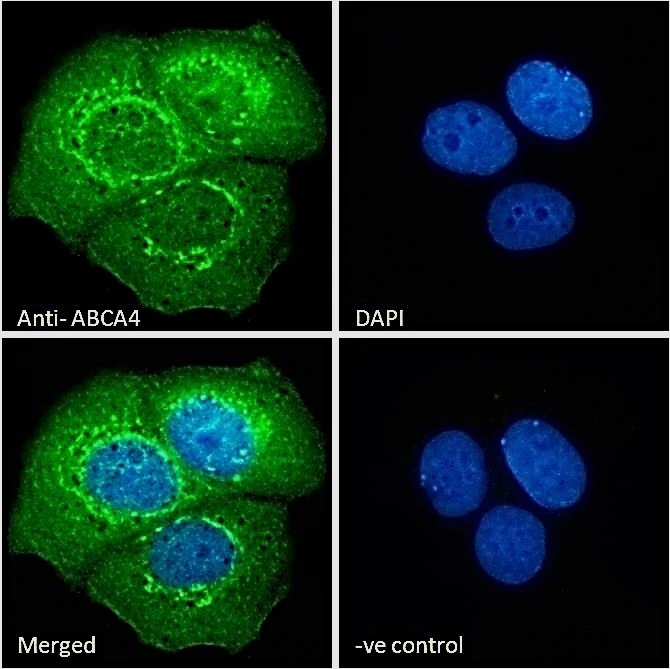 ICC/IF analysis of PFA-fixed MCF7 cells using GTX88710 ABCA4 antibody, C-term. Negative control (-ve) : Unimmunized goat IgG Permeabilization : 0.15% Triton Dilution : 10ug/ml ICC/IF analysis of PFA-fixed MCF7 cells using GTX88710 ABCA4 antibody, C-term. Negative control (-ve) : Unimmunized goat IgG Permeabilization : 0.15% Triton Dilution : 10ug/ml