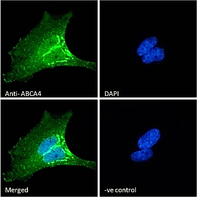 ICC/IF analysis of PFA-fixed HeLa cells using GTX88710 ABCA4 antibody, C-term. Negative control (-ve) : Unimmunized goat IgG Permeabilization : 0.15% Triton Dilution : 10ug/ml