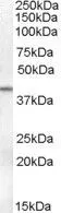 WB analysis of human ovary lysate using GTX88711 SERPINB6 antibody, Internal. Dilution : 0.1microg/ml Loading : 35microg protein in RIPA buffer WB analysis of human ovary lysate using GTX88711 SERPINB6 antibody, Internal. Dilution : 0.1microg/ml Loading : 35microg protein in RIPA buffer