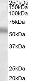 WB analysis of human lung lysate using GTX88723 TFEB antibody, Internal. Dilution : 1microg/ml Loading : 35microg protein in RIPA buffer WB analysis of human lung lysate using GTX88723 TFEB antibody, Internal. Dilution : 1microg/ml Loading : 35microg protein in RIPA buffer