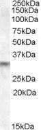WB analysis of human brain lysate using GTX88724 PRUNE2 antibody, Internal. Dilution : 1microg/ml Loading : 35microg protein in RIPA buffer WB analysis of human brain lysate using GTX88724 PRUNE2 antibody, Internal. Dilution : 1microg/ml Loading : 35microg protein in RIPA buffer