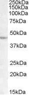 WB analysis of Daudi lysate using GTX88731 LHX2 antibody, C-term. Dilution : 1microg/ml Loading : 35microg protein in RIPA buffer WB analysis of Daudi lysate using GTX88731 LHX2 antibody, C-term. Dilution : 1microg/ml Loading : 35microg protein in RIPA buffer