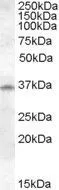 WB analysis of human lung lysate using GTX88744 Cathepsin K antibody, Internal (near N-term). Dilution : 1microg/ml Loading : 35microg protein in RIPA buffer WB analysis of human lung lysate using GTX88744 Cathepsin K antibody, Internal (near N-term). Dilution : 1microg/ml Loading : 35microg protein in RIPA buffer
