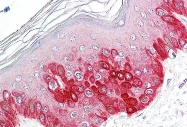 IHC-P analysis of human skin using GTX88747 ATG16L1 antibody, Internal. Antigen retrieval : citrate buffer pH 6 Dilution : 3.75microg/ml