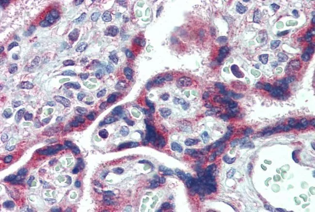 IHC-P analysis of human placenta using GTX88748 FMRP antibody, Internal. Antigen retrieval : citrate buffer pH 6 Dilution : 2.5microg/ml