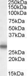 WB analysis of rat spinal cord lysate using GTX88751 MPZ antibody, Internal. Dilution : 0.1microg/ml Loading : 35microg protein in RIPA buffer WB analysis of rat spinal cord lysate using GTX88751 MPZ antibody, Internal. Dilution : 0.1microg/ml Loading : 35microg protein in RIPA buffer