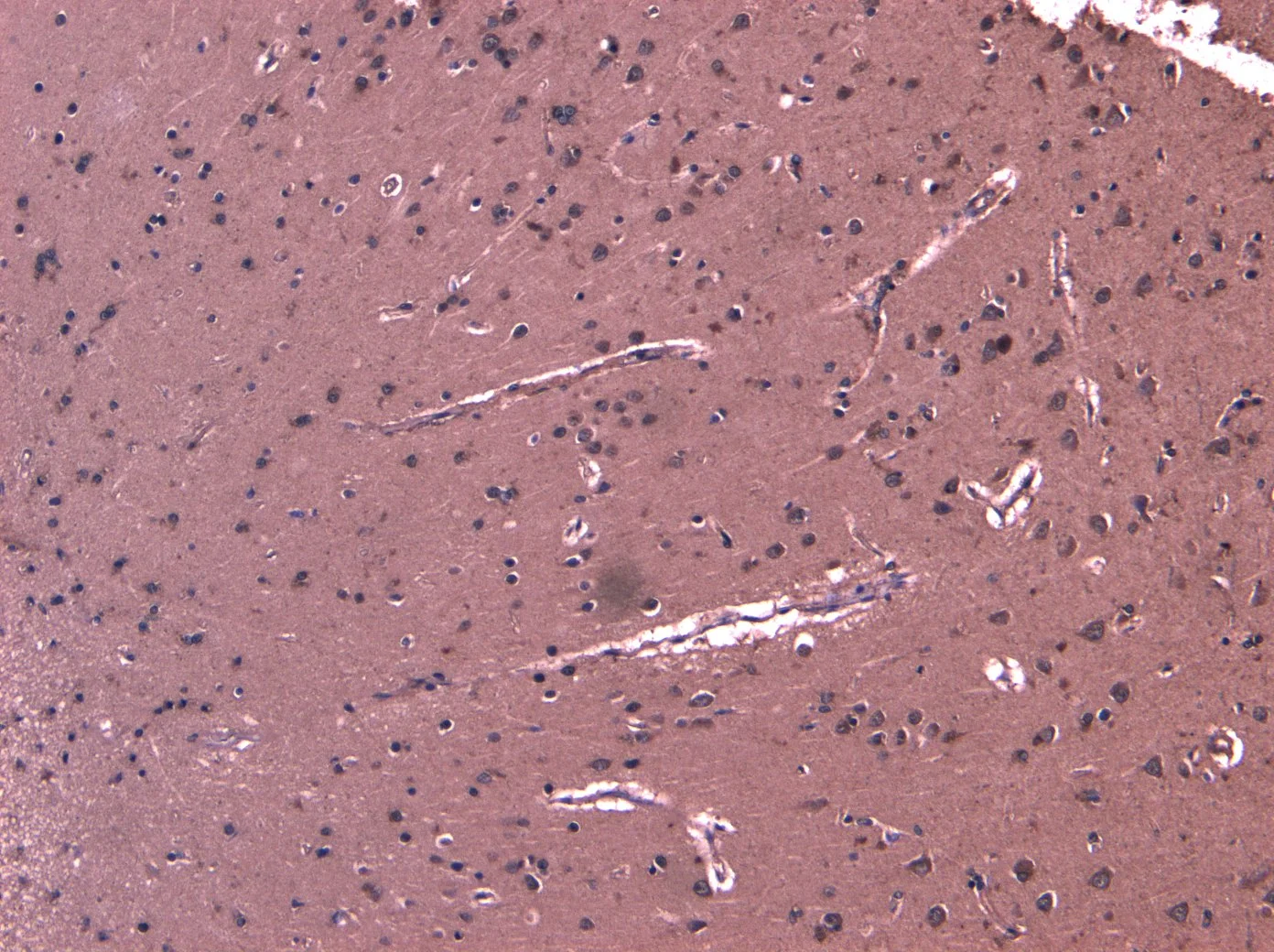 IHC-P analysis of human cortex tissue using GTX88752 DHX58 antibody, C-term. Antigen retrieval : Heat induced antigen retrieval with citrate buffer pH 6 Dilution : 8microg/ml