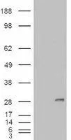 WB analysis of HEK293 overexpressing IGFBP6 (mock transfection in first lane) using GTX88766 IGFBP6 antibody, Internal.