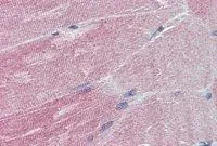 IHC-P analysis of human skeletal muscle using GTX88766 IGFBP6 antibody, Internal. Antigen retrieval : citrate buffer pH 6 Dilution : 5microg/ml