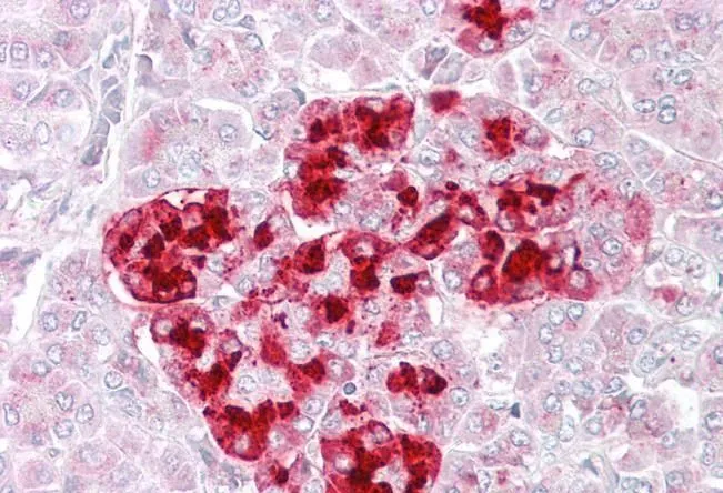 IHC-P analysis of human pancreas using GTX88767 IGFBP7 antibody, Internal. Antigen retrieval : citrate buffer pH 6 Dilution : 2.5microg/ml IHC-P analysis of human pancreas using GTX88767 IGFBP7 antibody, Internal. Antigen retrieval : citrate buffer pH 6 Dilution : 2.5microg/ml
